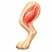 Muscle & tendon injuries - what ultrasound can diagnose